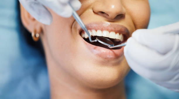 Professional Emergency Dental Service in SC